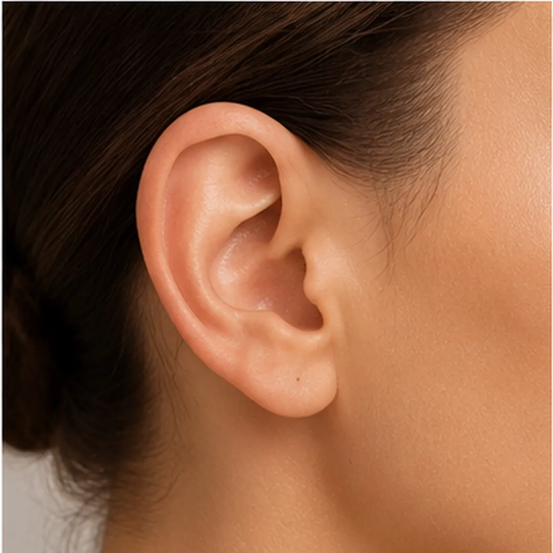 Otoplastia